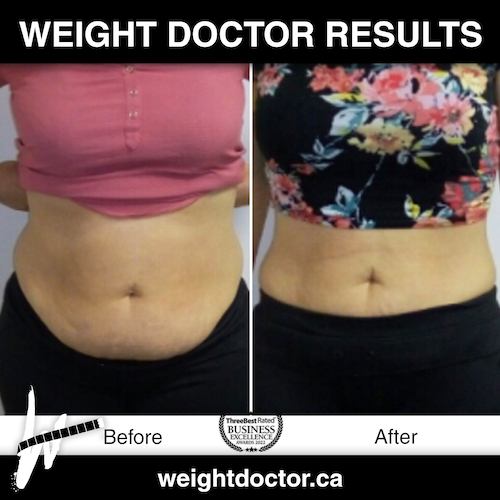 Before and after photos showcasing a Weight Doctor client's weight loss success. The left side of the image depicts the client before starting the Rapid Weight Loss program, appearing less confident and vibrant. The right side shows the same person after completing the programme, visibly slimmer, exuding confidence, energy, and a radiant smile, symbolizing a transformative journey to a healthier and happier sel